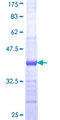 B3GALT6 Protein - 12.5% SDS-PAGE Stained with Coomassie Blue.