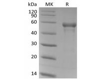 B3GAT1 Protein - Recombinant Human B3GAT1 (N-6His)