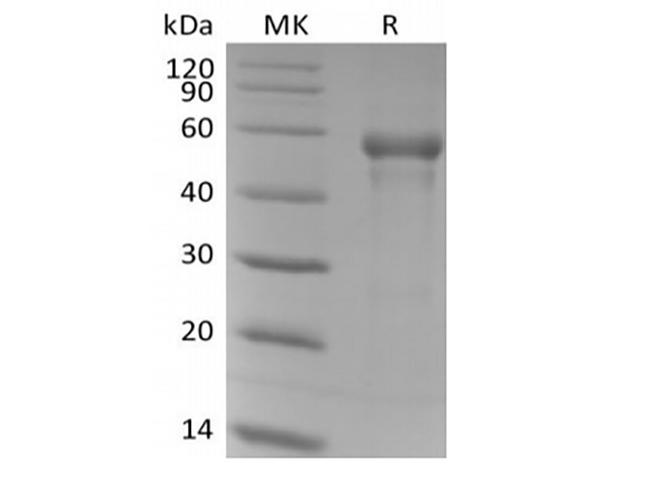 B3GAT1 Protein - Recombinant Human B3GAT1 (N-6His)