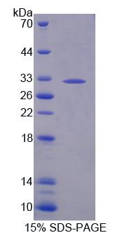 B3GAT2 Protein - Recombinant Beta-1,3-Glucuronyltransferase 2 (b3GAT2) by SDS-PAGE
