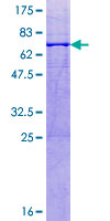 B3GAT3 Protein - 12.5% SDS-PAGE of human B3GAT3 stained with Coomassie Blue