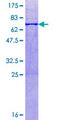 B3GAT3 Protein - 12.5% SDS-PAGE of human B3GAT3 stained with Coomassie Blue