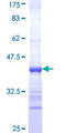 B3GAT3 Protein - 12.5% SDS-PAGE Stained with Coomassie Blue.