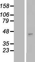 B3GNT3 / TMEM3 Protein - Western validation with an anti-DDK antibody * L: Control HEK293 lysate R: Over-expression lysate