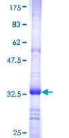 B3GNT3 / TMEM3 Protein - 12.5% SDS-PAGE Stained with Coomassie Blue.
