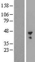 B3GNT6 Protein - Western validation with an anti-DDK antibody * L: Control HEK293 lysate R: Over-expression lysate