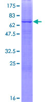 B3GNT6 Protein - 12.5% SDS-PAGE of human B3GNT6 stained with Coomassie Blue