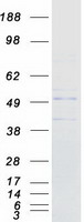 B3GNT6 Protein - Purified recombinant protein B3GNT6 was analyzed by SDS-PAGE gel and Coomassie Blue Staining