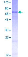 B3GNT7 Protein - 12.5% SDS-PAGE of human B3GNT7 stained with Coomassie Blue