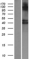 B3GNT8 Protein - Western validation with an anti-DDK antibody * L: Control HEK293 lysate R: Over-expression lysate