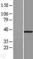 B3GNT9 Protein - Western validation with an anti-DDK antibody * L: Control HEK293 lysate R: Over-expression lysate