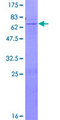 B4GALNT1 / GM2/GD2 Synthase Protein - 12.5% SDS-PAGE of human B4GALNT1 stained with Coomassie Blue