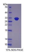 B4GALNT2 Protein - Recombinant  Beta-1,4-N-Acetyl Galactosaminyl Transferase 2 By SDS-PAGE