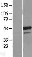 B4GALT3 Protein - Western validation with an anti-DDK antibody * L: Control HEK293 lysate R: Over-expression lysate