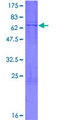 B4GALT3 Protein - 12.5% SDS-PAGE of human B4GALT3 stained with Coomassie Blue