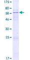 B4GALT4 Protein - 12.5% SDS-PAGE of human B4GALT4 stained with Coomassie Blue