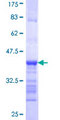 B4GALT4 Protein - 12.5% SDS-PAGE Stained with Coomassie Blue.