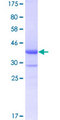 B4GALT5 Protein - 12.5% SDS-PAGE Stained with Coomassie Blue.