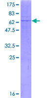 B4GALT6 Protein - 12.5% SDS-PAGE of human B4GALT6 stained with Coomassie Blue