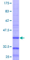 B4GALT6 Protein - 12.5% SDS-PAGE Stained with Coomassie Blue.