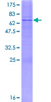 B4GALT7 Protein - 12.5% SDS-PAGE of human B4GALT7 stained with Coomassie Blue