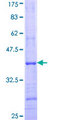B4GALT7 Protein - 12.5% SDS-PAGE Stained with Coomassie Blue.