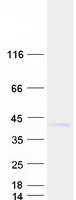 B4GALT7 Protein - Purified recombinant protein B4GALT7 was analyzed by SDS-PAGE gel and Coomassie Blue Staining