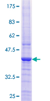 B9D1 Protein - 12.5% SDS-PAGE of human EPPB9 stained with Coomassie Blue