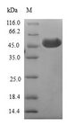 B9D2 Protein - (Tris-Glycine gel) Discontinuous SDS-PAGE (reduced) with 5% enrichment gel and 15% separation gel.