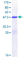 BAALC Protein - 12.5% SDS-PAGE of human BAALC stained with Coomassie Blue