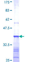 BAAT / BAT Protein - 12.5% SDS-PAGE Stained with Coomassie Blue.