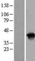 BABAM1 / HSPC142 Protein - Western validation with an anti-DDK antibody * L: Control HEK293 lysate R: Over-expression lysate