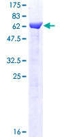 BABAM1 / HSPC142 Protein - 12.5% SDS-PAGE of human C19orf62 stained with Coomassie Blue