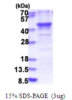 BABAM1 / HSPC142 Protein