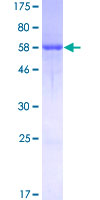 BABP / AKR1C2 Protein - 12.5% SDS-PAGE of human AKR1C2 stained with Coomassie Blue