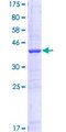 BABP / AKR1C2 Protein - 12.5% SDS-PAGE Stained with Coomassie Blue.