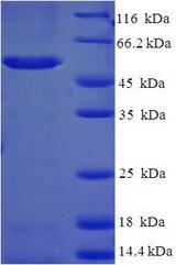 BABP / AKR1C2 Protein