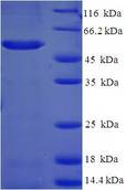 BABP / AKR1C2 Protein