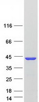BABP / AKR1C2 Protein - Purified recombinant protein AKR1C2 was analyzed by SDS-PAGE gel and Coomassie Blue Staining