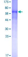 BACE1 / BACE Protein - 12.5% SDS-PAGE of human BACE1 stained with Coomassie Blue