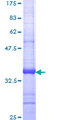 BACE2 Protein - 12.5% SDS-PAGE Stained with Coomassie Blue.