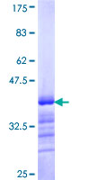 BACH1 Protein - 12.5% SDS-PAGE Stained with Coomassie Blue.
