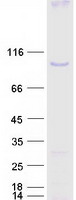 BACH1 Protein - Purified recombinant protein BACH1 was analyzed by SDS-PAGE gel and Coomassie Blue Staining