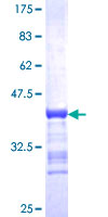 BACH2 Protein - 12.5% SDS-PAGE Stained with Coomassie Blue.