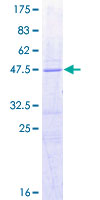 BAD Protein - 12.5% SDS-PAGE of human BAD stained with Coomassie Blue
