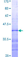 BAD Protein - 12.5% SDS-PAGE Stained with Coomassie Blue.