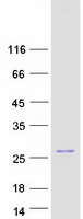 BAD Protein - Purified recombinant protein BAD was analyzed by SDS-PAGE gel and Coomassie Blue Staining