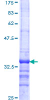 BAF60B / SMARCD2 Protein - 12.5% SDS-PAGE Stained with Coomassie Blue.