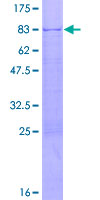 BAF60C / SMARCD3 Protein - 12.5% SDS-PAGE of human SMARCD3 stained with Coomassie Blue