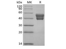BAFF Receptor / CD268 Protein - Recombinant Human BAFFR/TNFRSF13C (C-Fc)